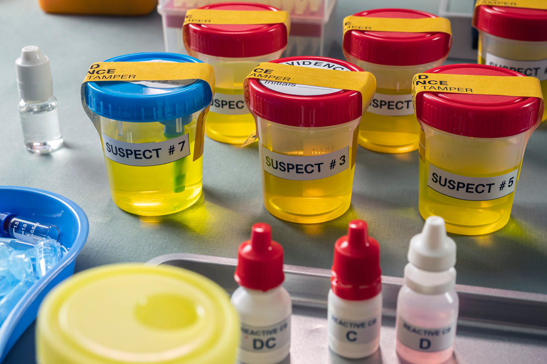 尿液檢查能夠檢查出的甚麼疾病?尿液如何進行分析?